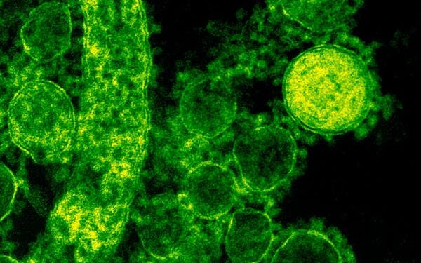 புதிய வைரஸ் காய்ச்சலால் தினமும் 40 குழந்தைகள் கொழும்பு லேடி ரிட்ஜ்வே சிறுவர் வைத்தியசாலையில் அனுமதி – டாக்டர் ஜி விஜேசூரிய!