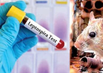 எலிக் காய்ச்சலின் தாக்கம் அதிகரித்துள்ளது-இலங்கை மருத்துவ சங்கம்!