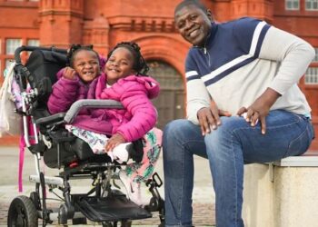 ஒட்டிப் பிறந்த இரட்டை சகோதரிகள்: பிழைக்க வாய்ப்பில்லை என்று மருத்துவர்கள் கூறியதை பொய்யாக்கிய கதை