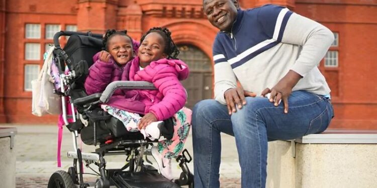 ஒட்டிப் பிறந்த இரட்டை சகோதரிகள்: பிழைக்க வாய்ப்பில்லை என்று மருத்துவர்கள் கூறியதை பொய்யாக்கிய கதை