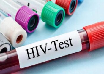 2023 இல் எச்.ஐ.வி/எயிட்ஸ் நோயாளிகளின் அதிகரிப்பை இலங்கை காண்கிறது