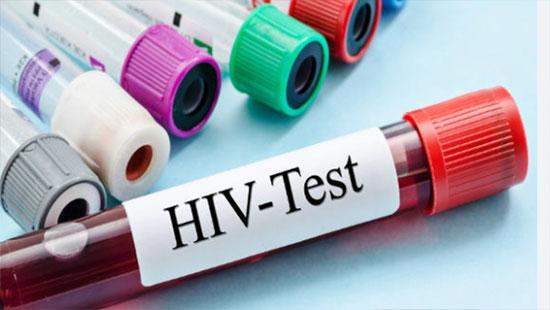 2023 இல் எச்.ஐ.வி/எயிட்ஸ் நோயாளிகளின் அதிகரிப்பை இலங்கை காண்கிறது